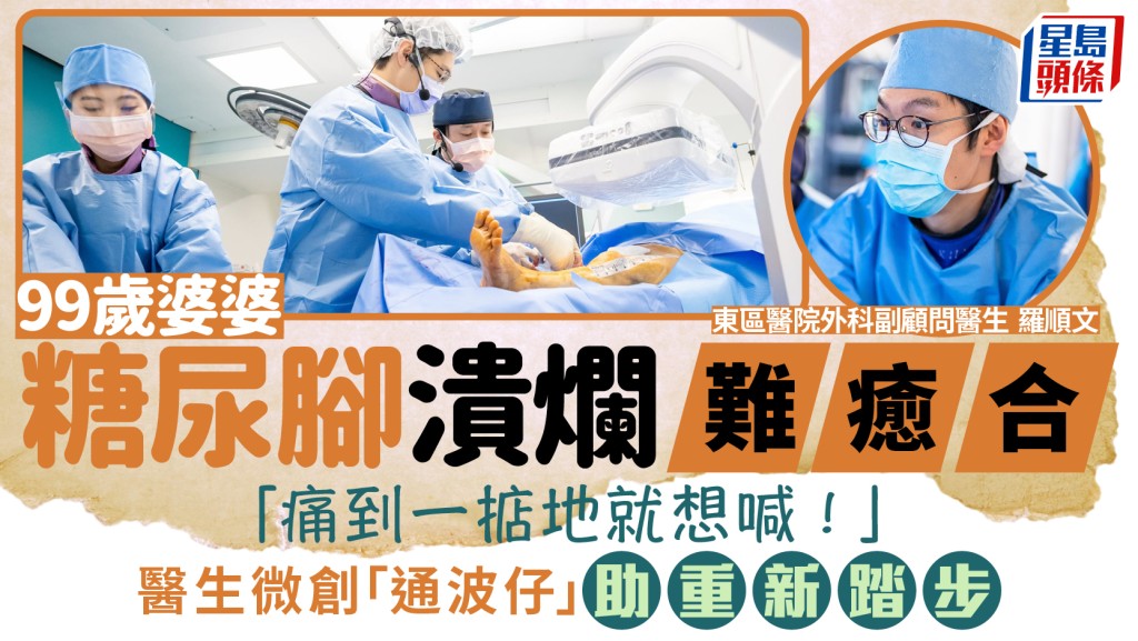 糖尿病｜「痛到一掂地就想喊！」99歲婆婆糖尿腳潰爛難癒合 醫生微創「通波仔」助重新踏步