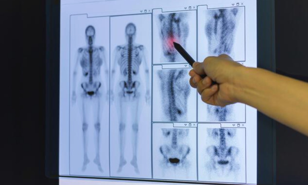 當地警方初期以涉嫌「過失致死」偵辦主刀及助理醫生，惟最新驗屍報告令案情出現大反轉。Alamy示意圖