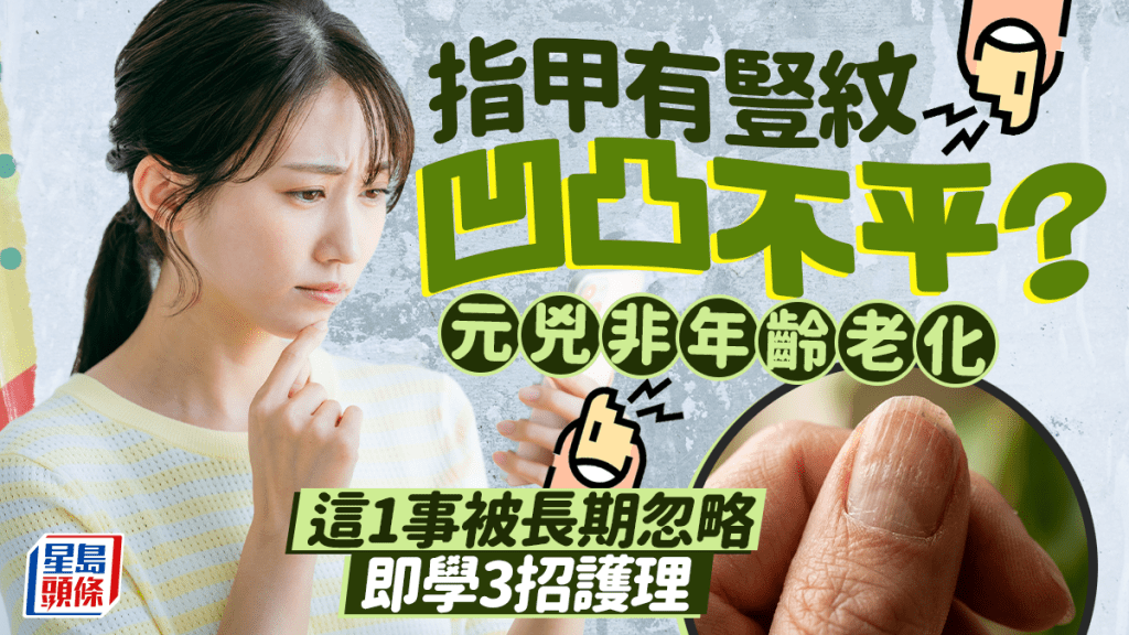 指甲有豎紋凹凸不平？專家揭元兇非老化 乾燥警號被長期忽略 即學3招護理