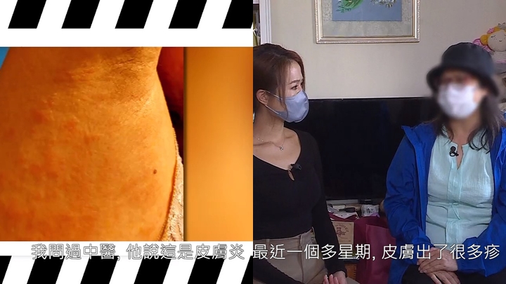 《東張西望》今晚報道有葵涌村居民反映,長期疑被上層住戶淋漂白水影響生活。