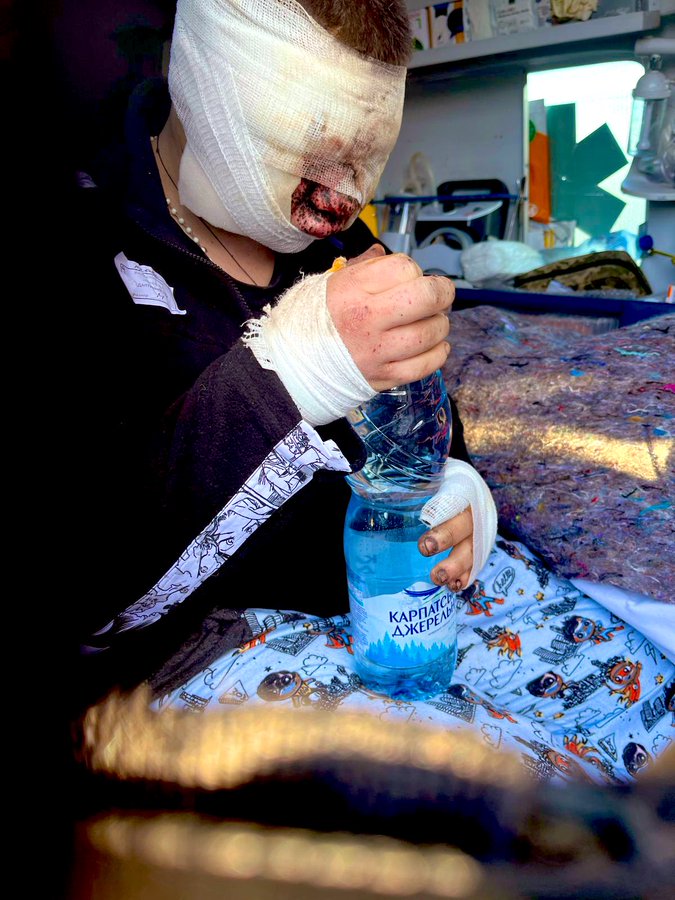 網傳烏方化武受害者的傷勢照片。 X