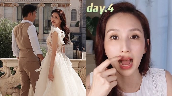 何傲兒結婚丨兩年前突然面癱以中西合壁治療 花三個半月時間康復仍留後遺症