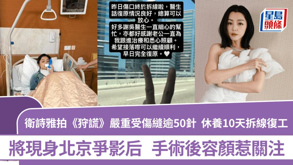 衛詩雅拍《狩謊》嚴重受傷縫逾50針  休養10天拆線復工將現身北京  手術後容顏惹關注