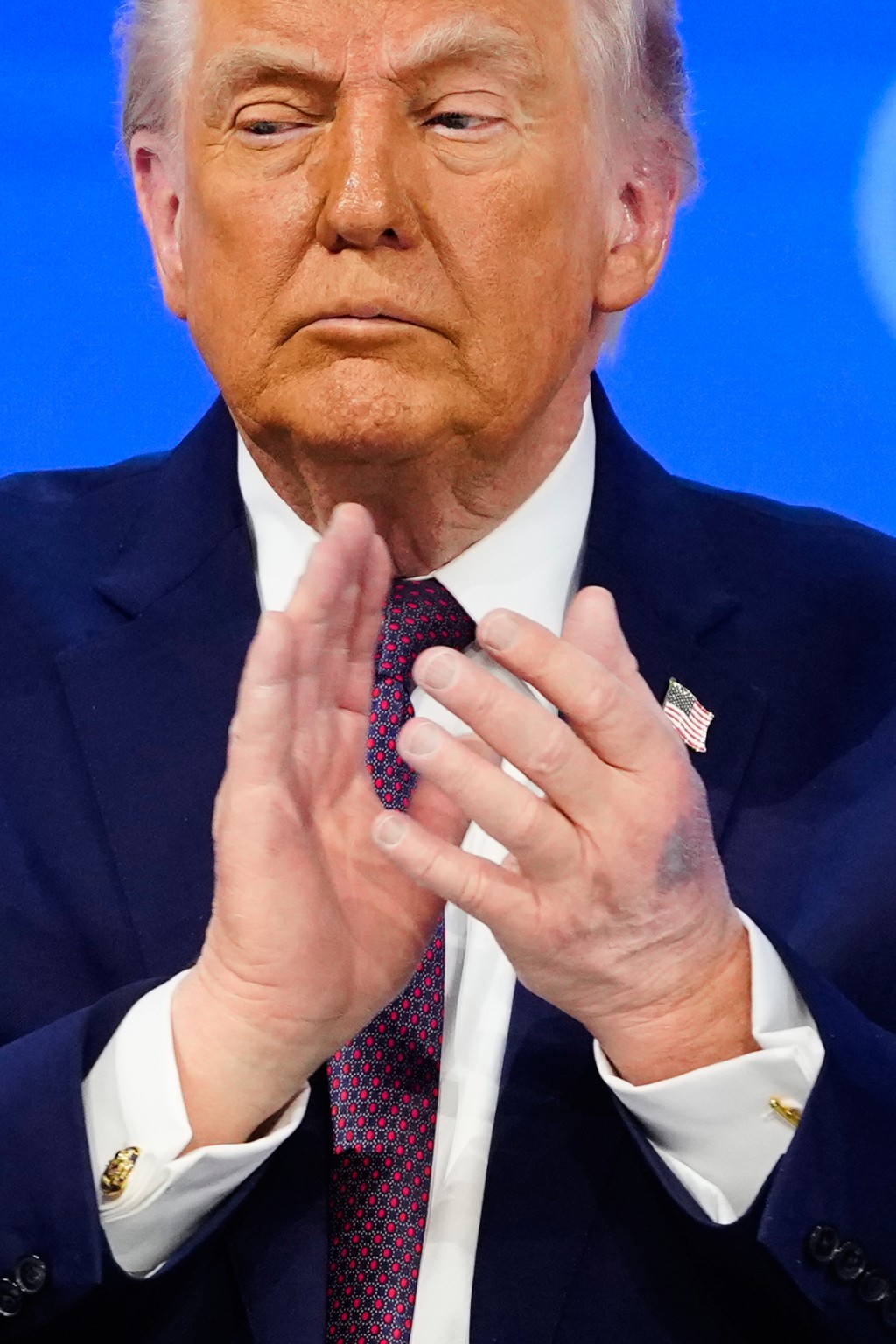 特朗普手瘀照再次引起熱議。美聯社 特朗普手瘀照再次引起熱議。美聯社