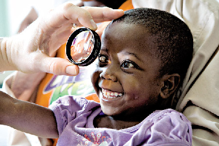 在砂眼流行的地區，活動性砂眼在學齡兒童中極為常見，患病率可高達60至90%。