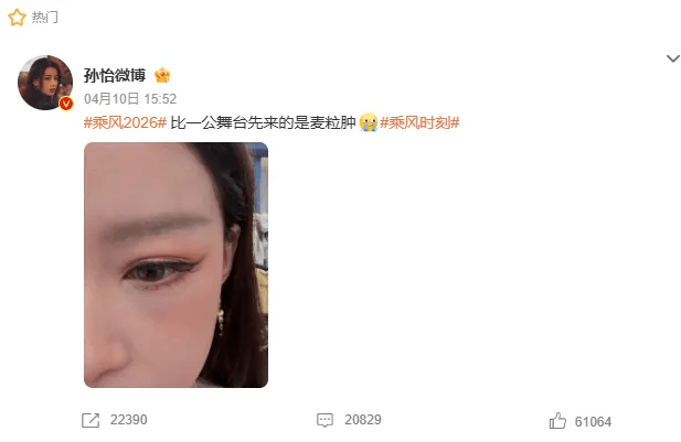 孙怡晒发布得眼挑针的照片。 孙怡晒发布得眼挑针的照片。