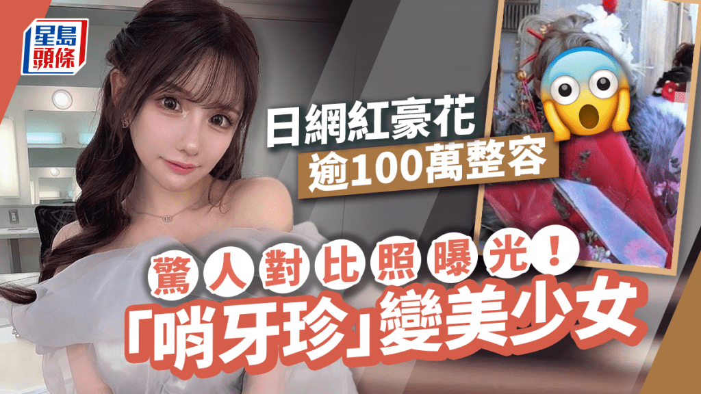 日網紅花逾100萬整容!驚人對比照曝光 哨牙單眼皮變甜美少女