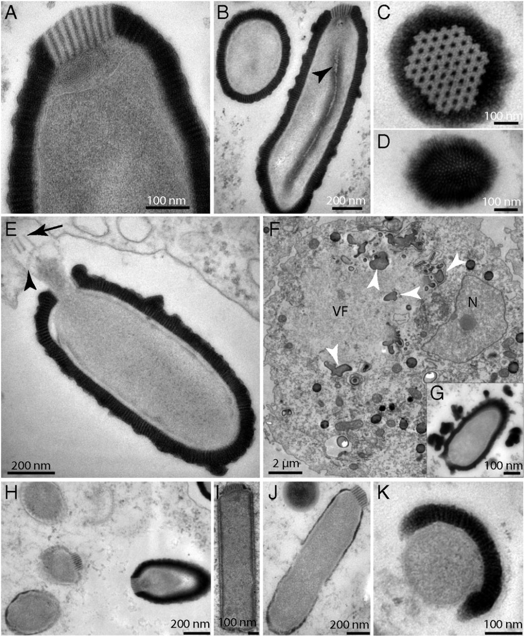 克拉維里（Jean-Michel Claverie）團隊2014年成功復活30000年歷史、可感染阿米巴原蟲的病毒。 網上圖片