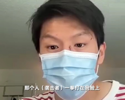 中國留學生在加拿大被持刀男子襲擊。網上圖片