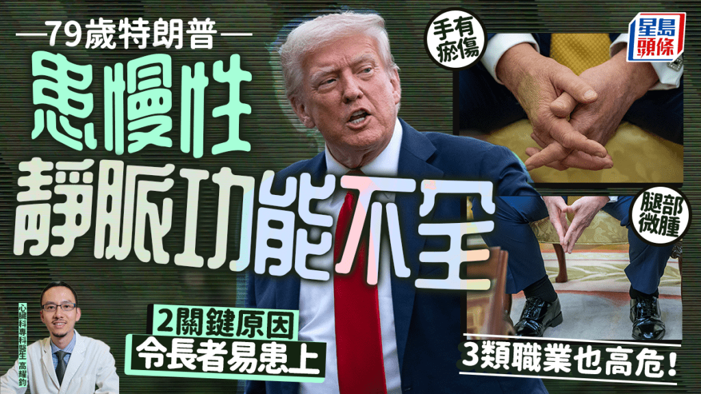 79歲特朗普患慢性靜脈功能不全 醫生揭2原因令長者易患上 3類職業也高危！