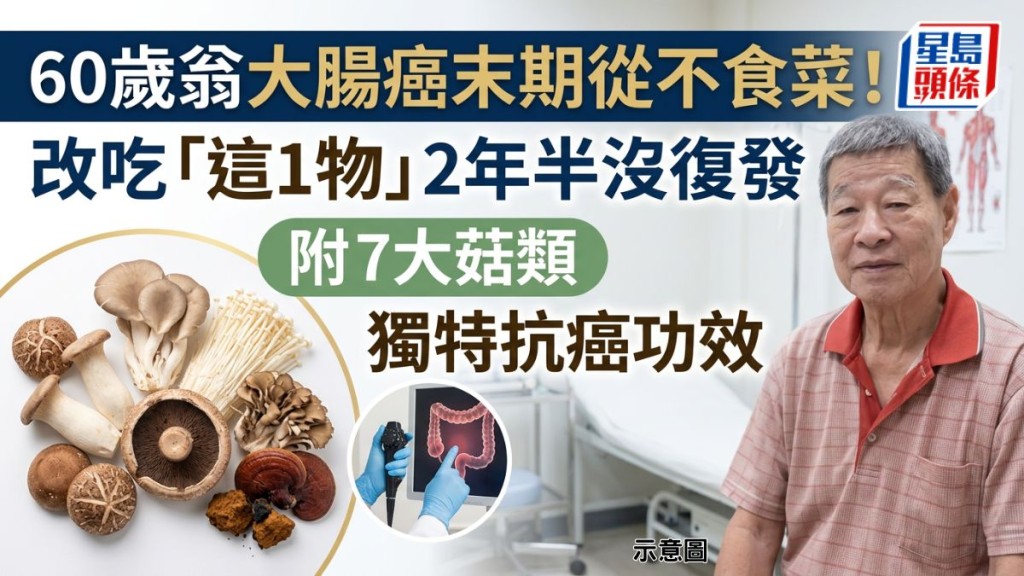 60歲翁大腸癌末期從不食菜！改吃菇類2年半沒復發 附7大菇類獨特抗癌功效