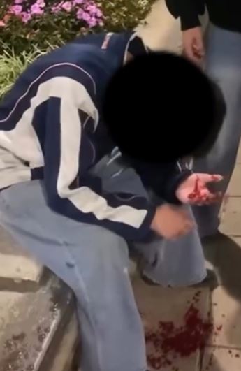 可見傷者左手掌心有大灘血迹。網片截圖
