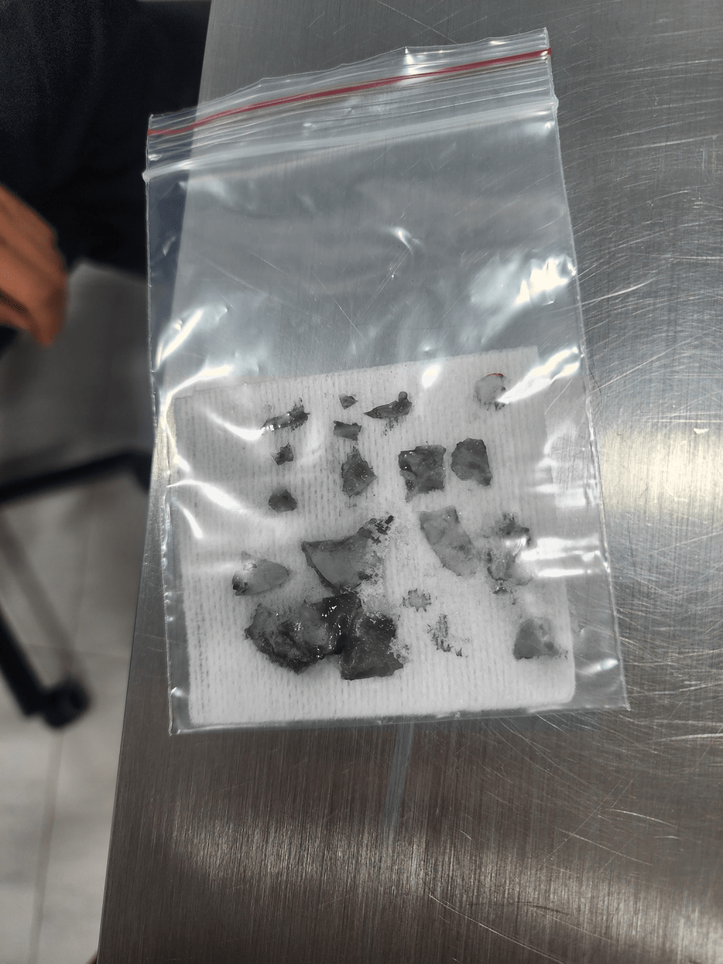 獸醫在手術期間，在約瑟爹利顱內取出多達18塊碎片。fb「NPV非牟利獸醫服務協會」圖片