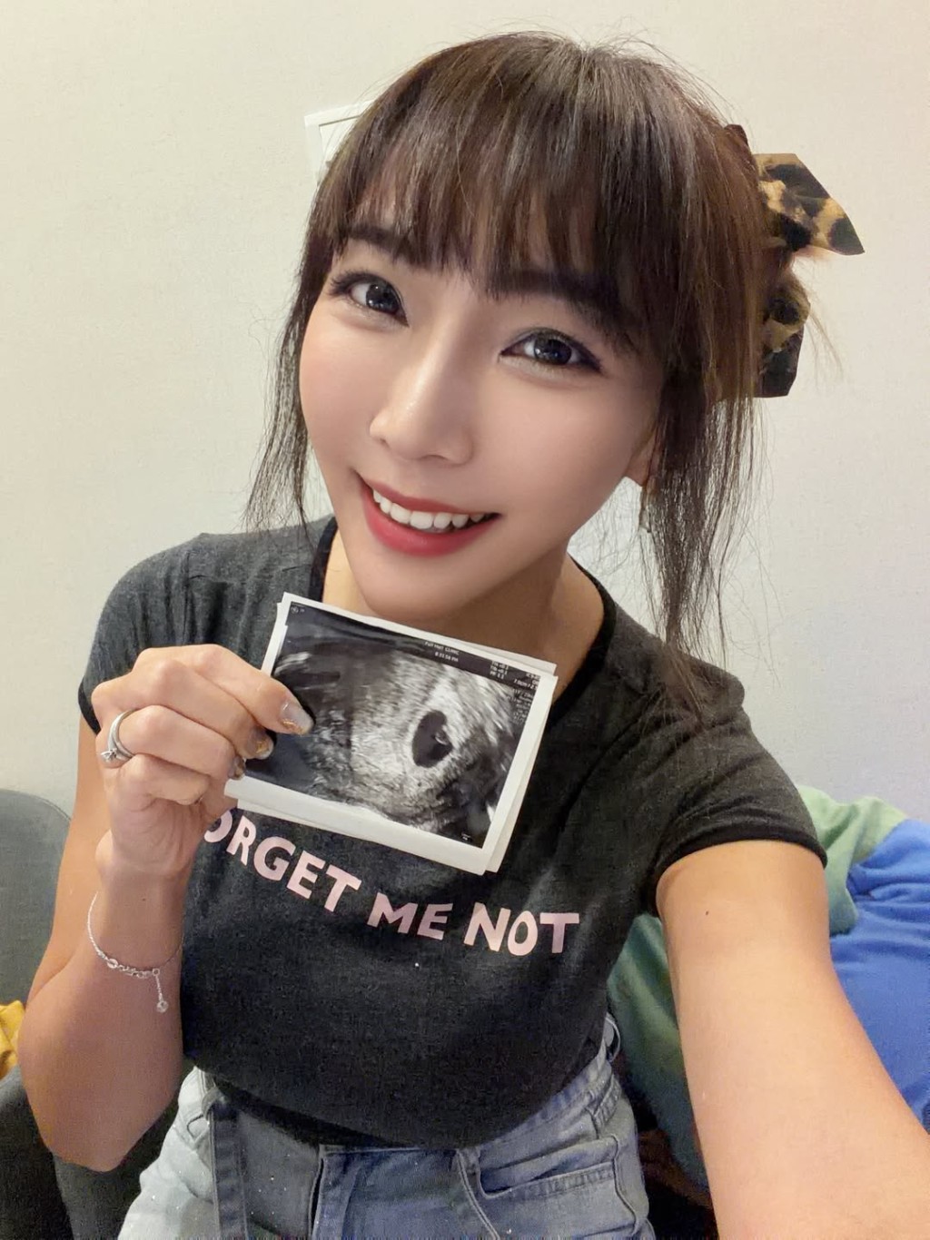 李宓過去一直依賴試管嬰兒療程受孕,想不到今次竟然出現奇蹟。 李宓過去一直依賴試管嬰兒療程受孕,想不到今次竟然出現奇蹟。