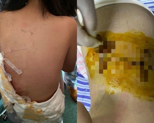 女童遭洛威拿犬咬至重傷。 網圖