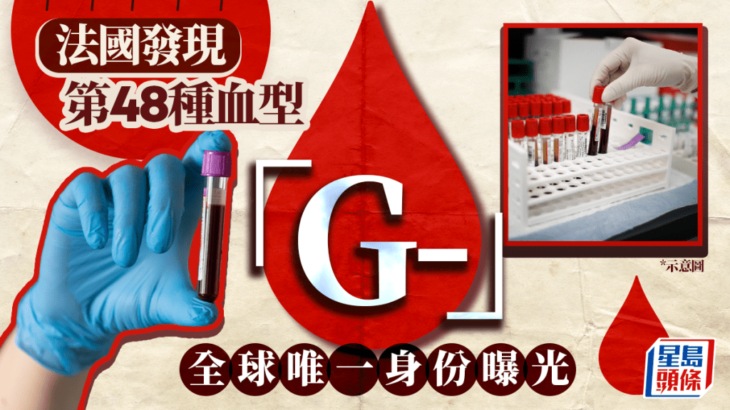 法國發現第48種血型 全球僅1人擁有