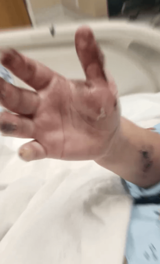 Lorenzo Lopez身上被電流灼傷的疤痕令人悚目驚心。