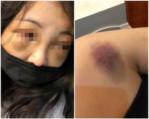 少女被圍毆長達10分鐘。網圖
