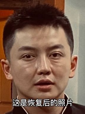 金大威指整容後瞬間老了20多歲。網圖