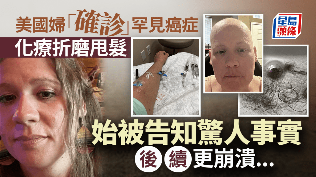美國婦確診超罕見癌症 化療折磨掉光頭髮後被告知從未得病