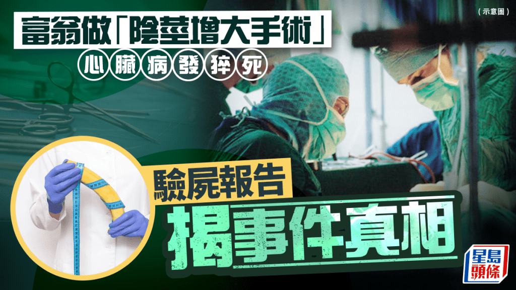 亿万富豪动「阴茎增大手术」猝死  验尸报告揭案情大反转