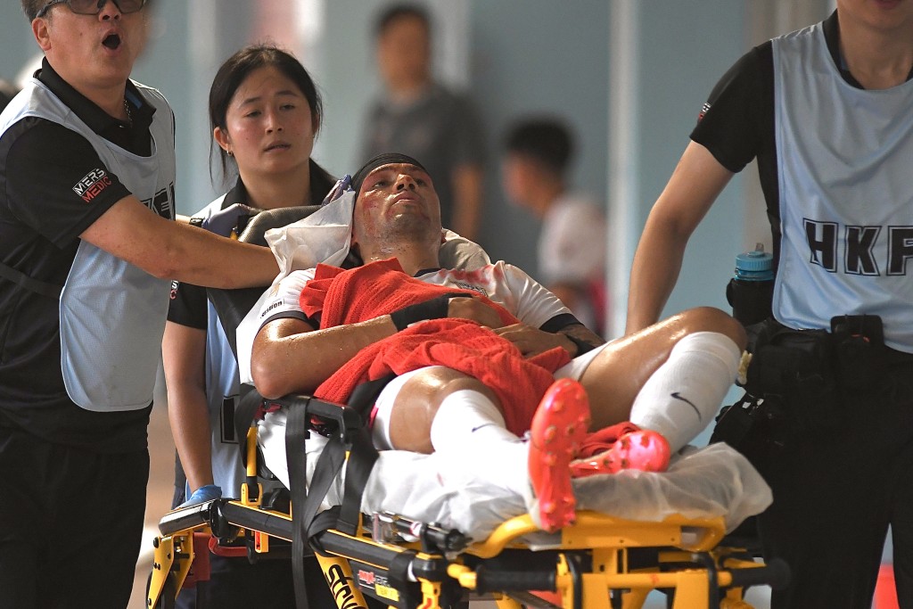 后备上阵的祖连奴于下半场75分钟头槌攻门后收掣不及,头部撞向门柱,需即场送院接受治理。杨骏尧摄 后备上阵的祖连奴于下半场75分钟头槌攻门后收掣不及,头部撞向门柱,需即场送院接受治理。杨骏尧摄