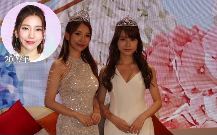 羅思雅驚現「阿凡達鼻」,她指因受傷而接受微調。