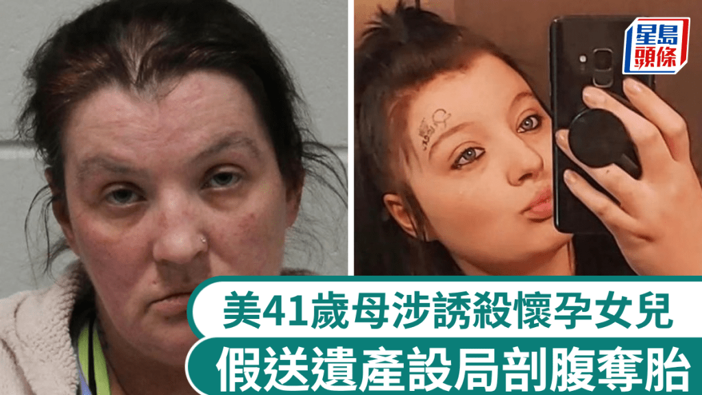美惡母誘殺22歲懷孕女兒剖腹奪胎，驚爆曾與準女婿偷情5個月。