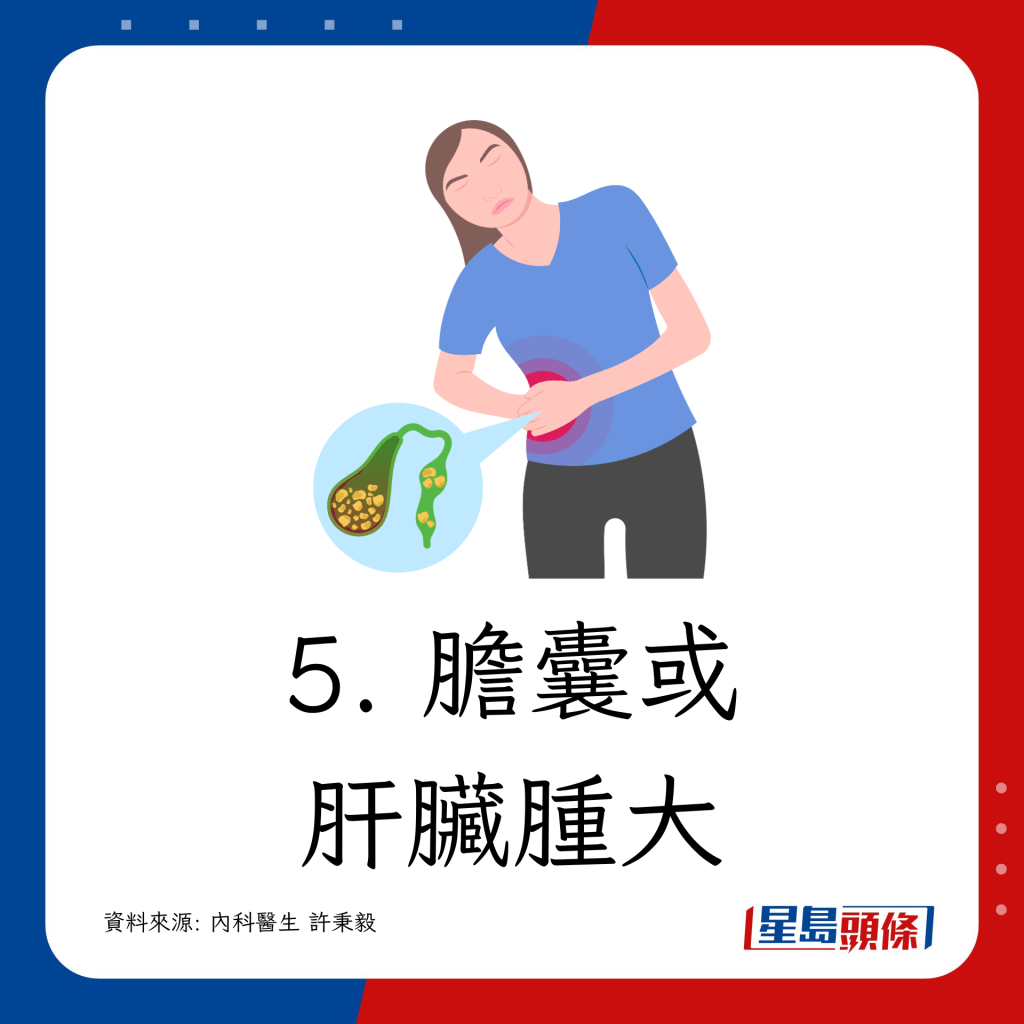 5. 膽囊或肝臟腫大
