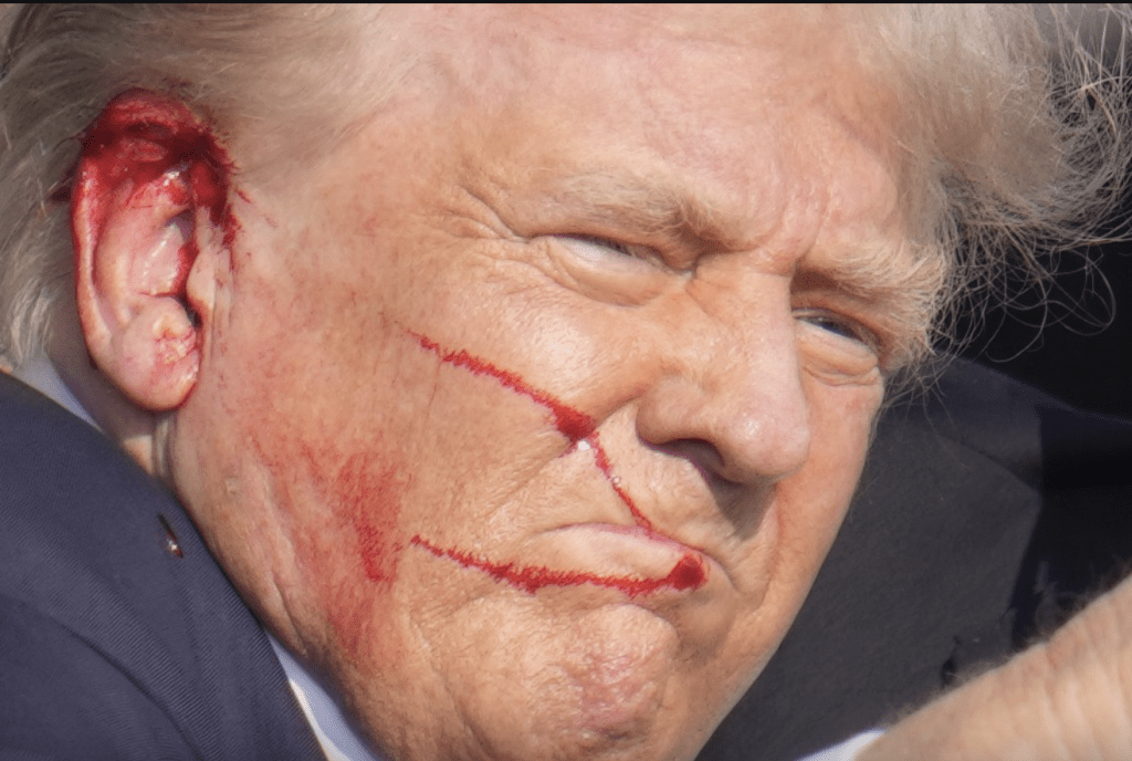 子彈在特朗普臉部划過後，記者拍到他的右耳隨即浴血。美聯社