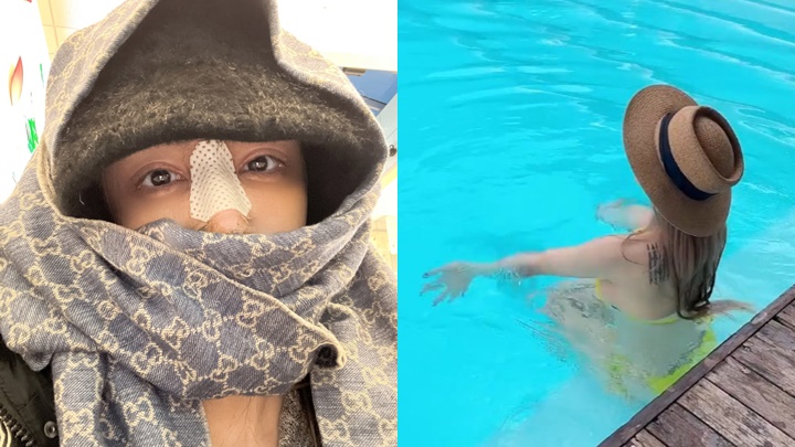 性感女星公開恐怖整容過程  面上插管畫面驚嚇曝光  豪擲7位數全身大執逾廿次