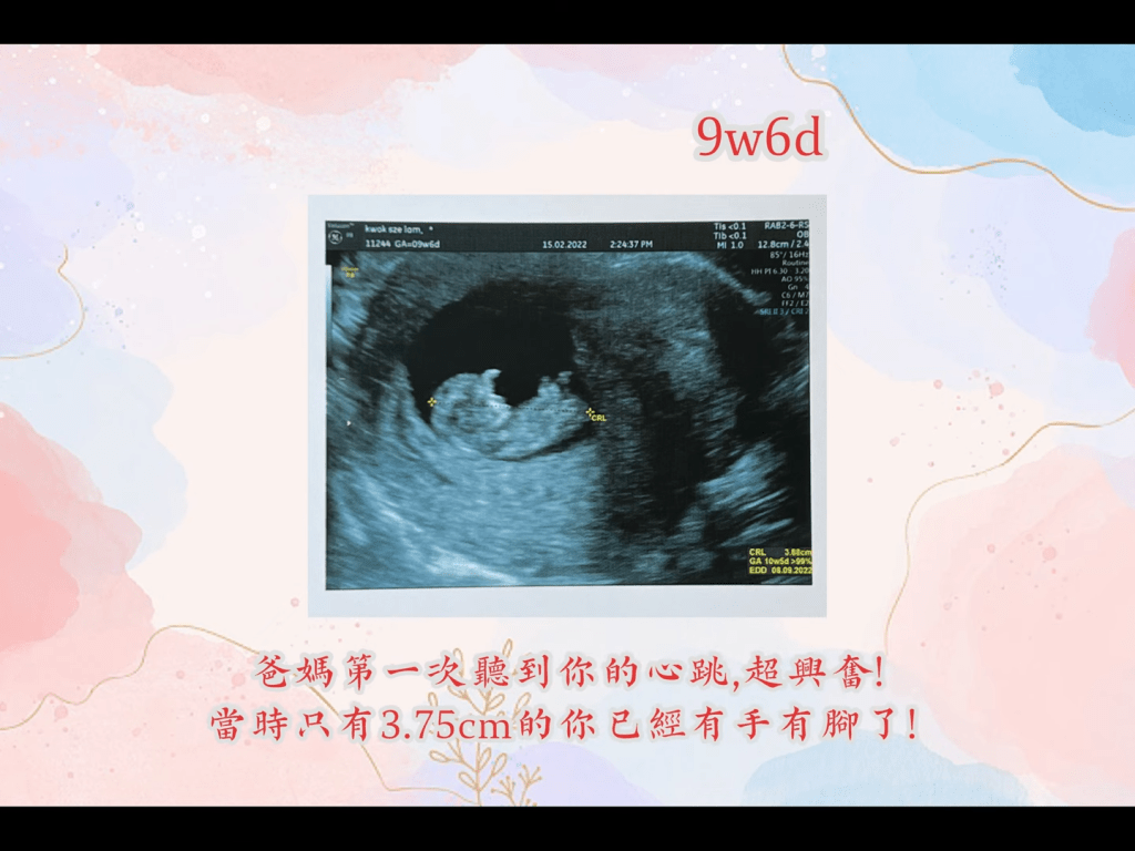 每张超声波都大方分享。