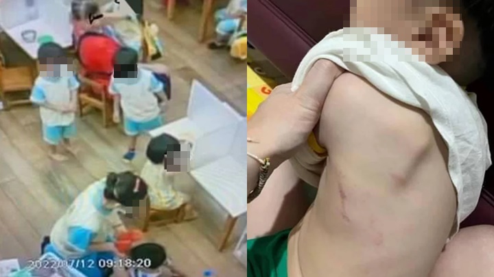 桃園市有幼兒園教師涉嫌虐童，園方及教師均受重罰。網上圖片