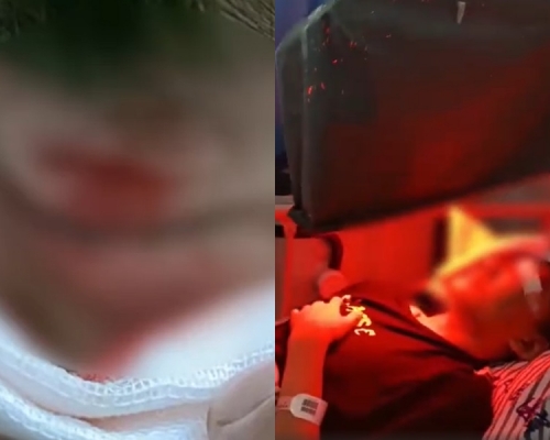 男生左眼被班主任打傷留醫。網圖