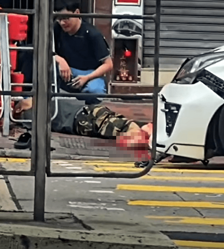 男傷者雙腳重創。網圖