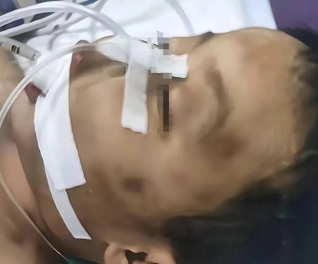 上海三歲男童黃某某遭生父女友虐待致死。