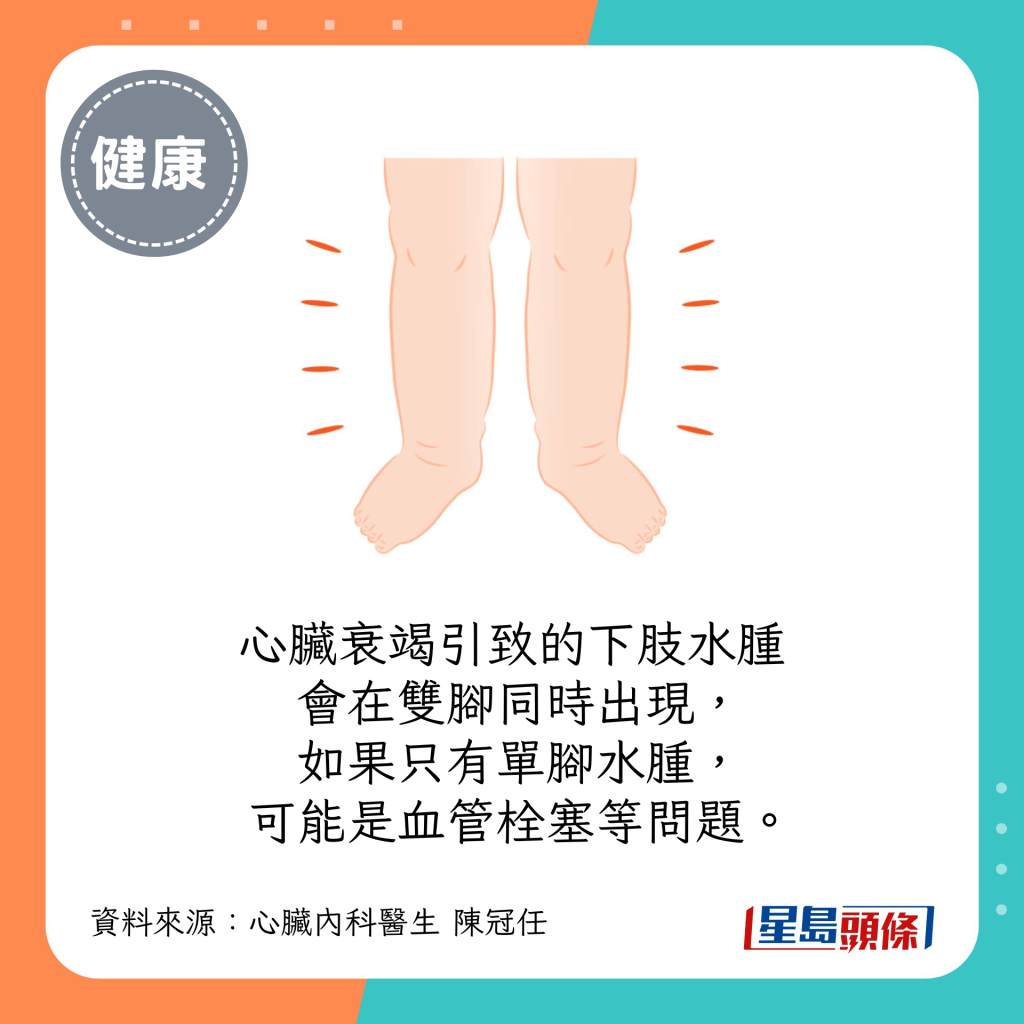 心臟衰竭引致的下肢水腫會在雙腳同時出現，如果只有單腳水腫，可能是血管栓塞等問題。