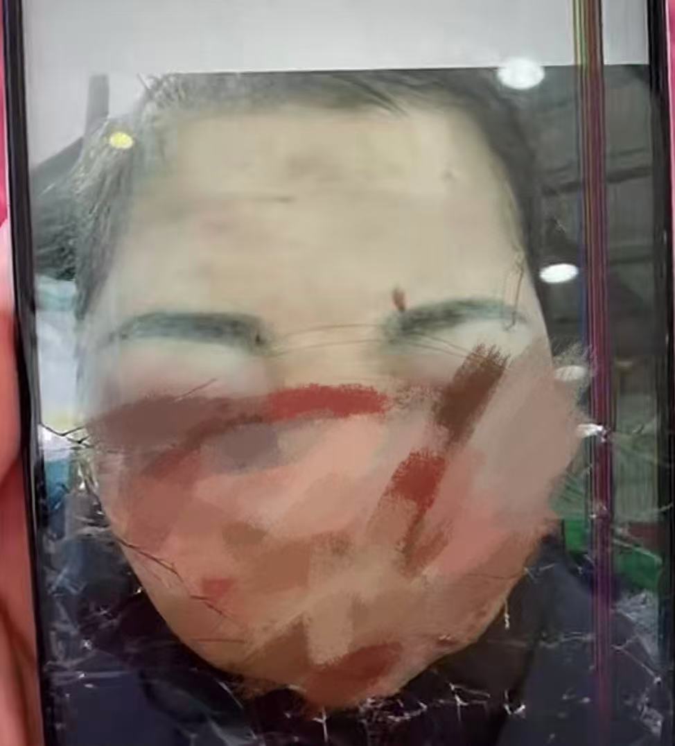 遼寧43歲女子遭前夫毒打直腸破裂亡。抖音@張麗萍女兒-嚴懲兇手