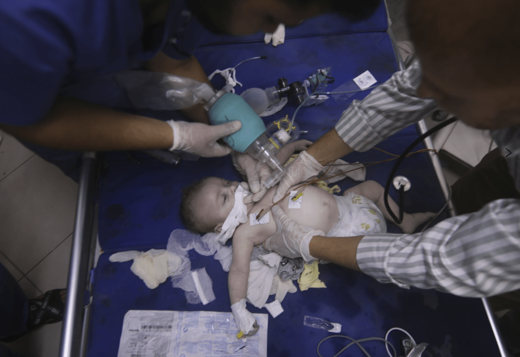 救援人員正搶救一名在以軍轟炸中受傷的嬰兒。美聯社