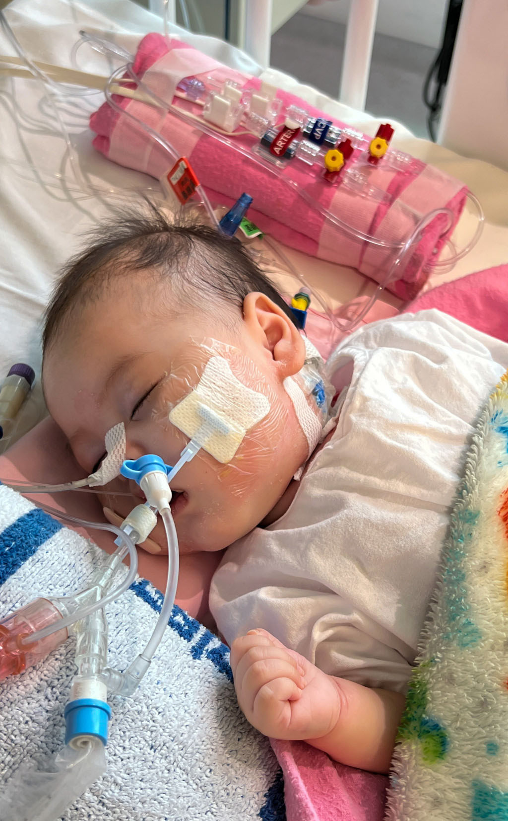 4个月大女婴芷希完成心脏移植手术。资料图片