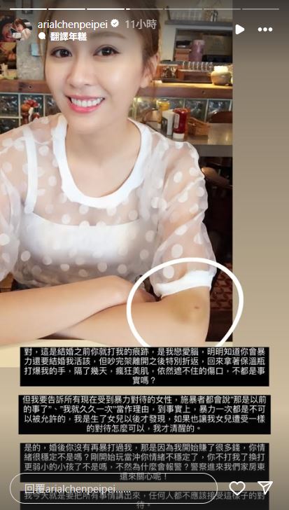 陳佩佩於社交網大爆料。 陳佩佩於社交網大爆料。