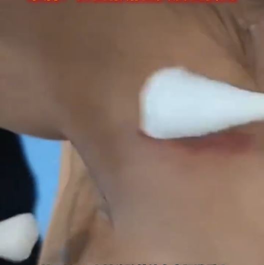 男童身體多處受傷要消毒及注射狂犬病疫苗。抖音@社會與法