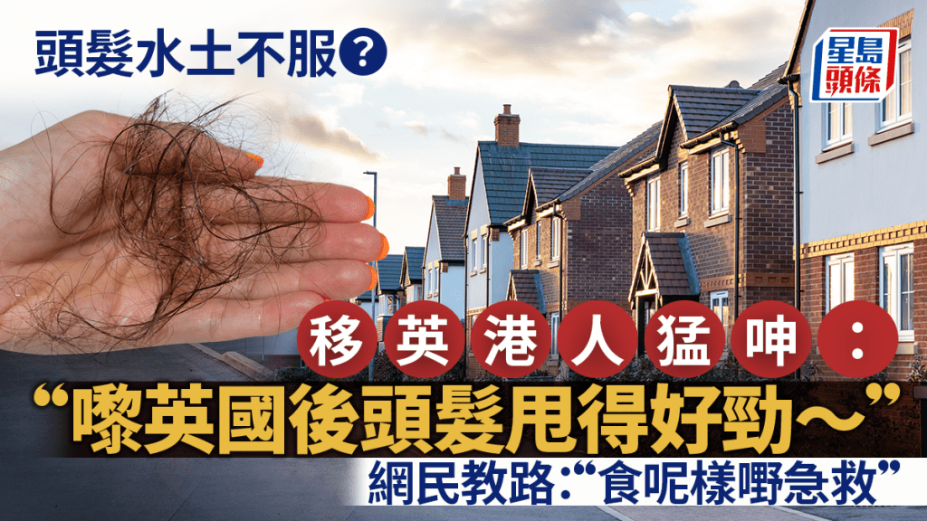 移英港人猛呻:嚟英國後勁甩頭髮 網民盤點原因教路:食呢樣嘢急救