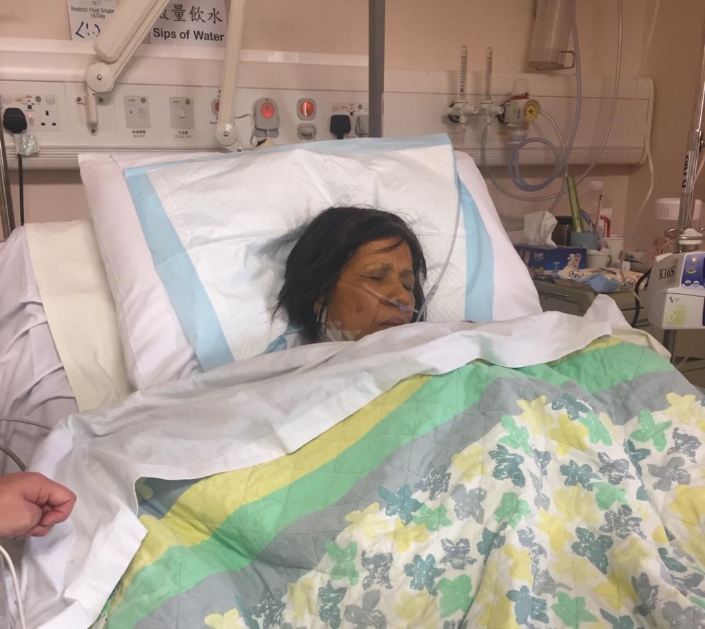 61岁的郭玉治急性肝衰竭陷入昏迷。