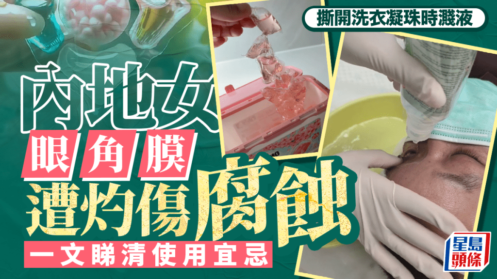 洗衣凝珠︱內地人妻撕開濺液傷眼角膜  洗衣珠宜忌一文看清