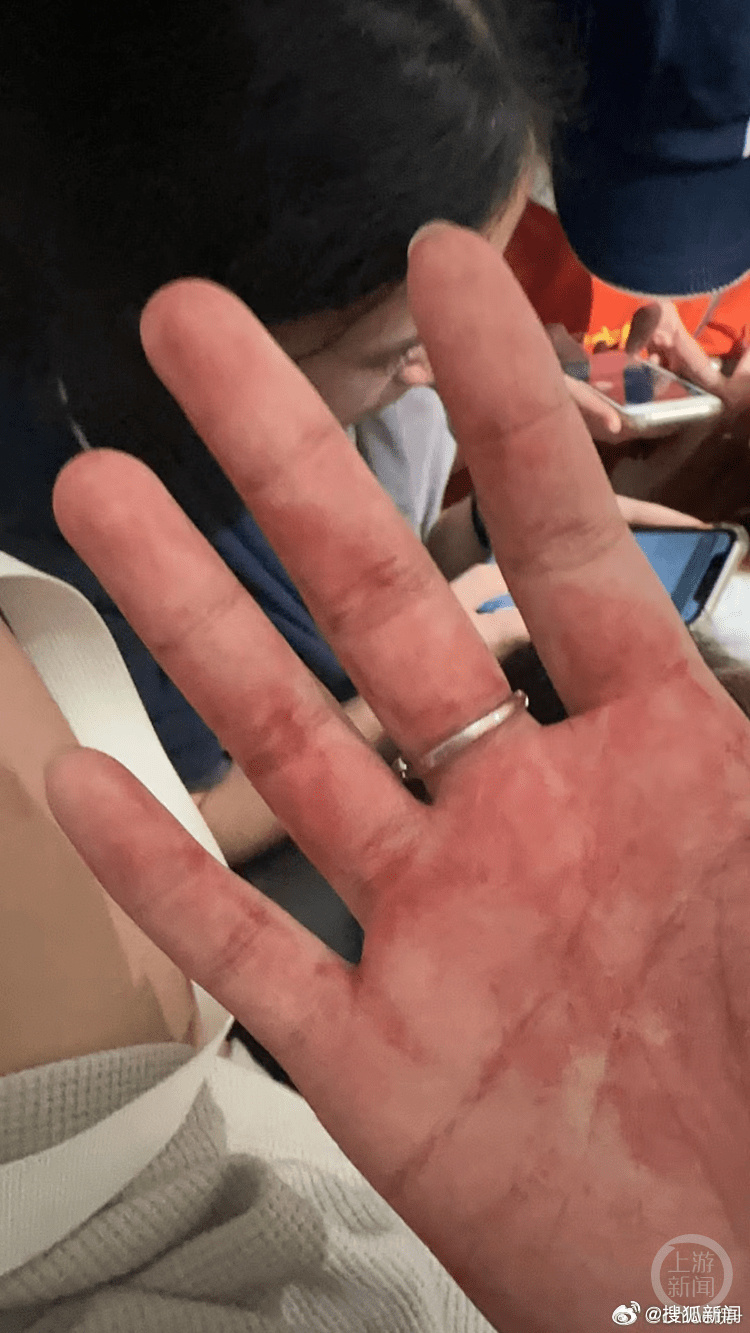 有中國遊客事後展示自己手上有血。