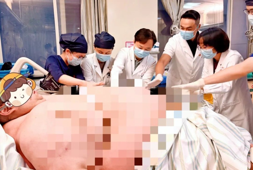 近700磅男心肺衰竭瀕死,跨省赴武漢搶救13天保命。 近700磅男心肺衰竭瀕死,跨省赴武漢搶救13天保命。