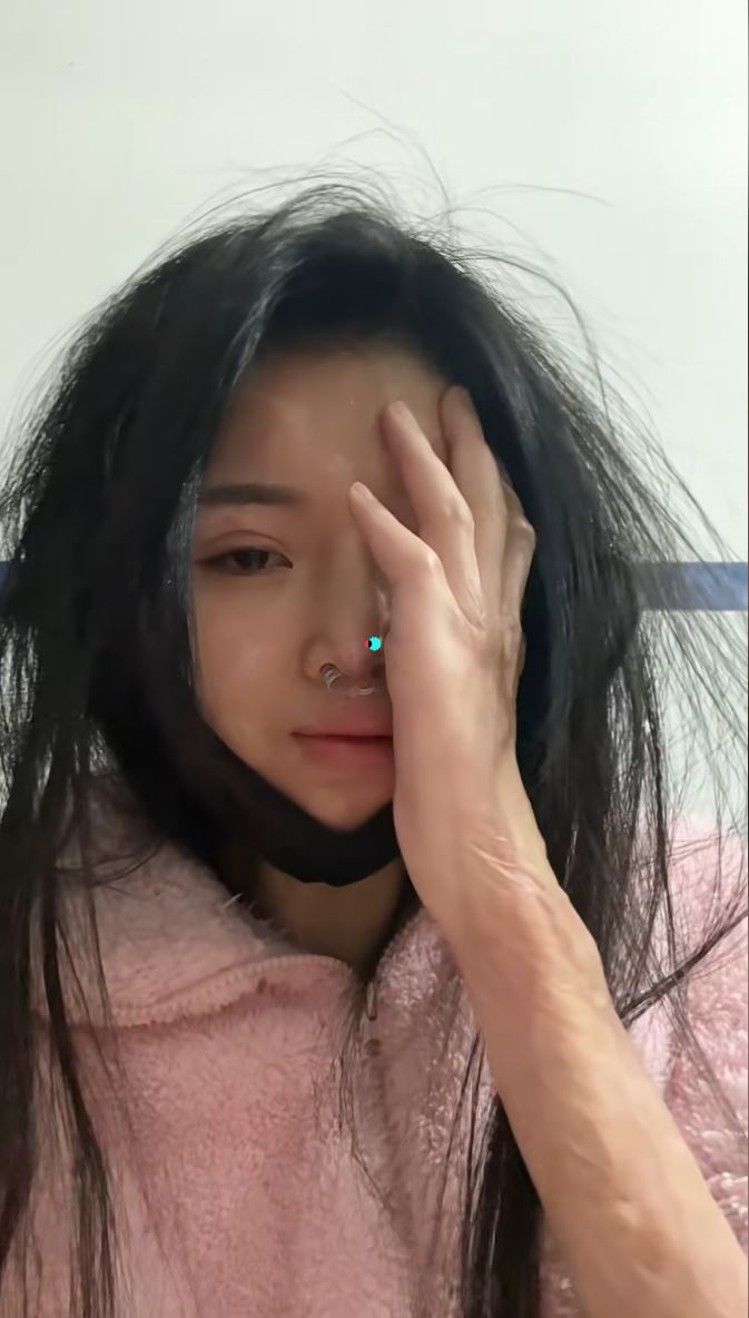 小兰被韦东传毁容及伤至双手失去生活能力。