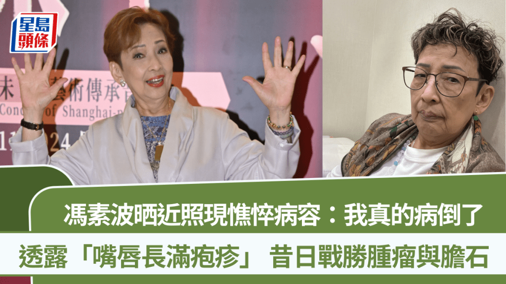 馮素波晒近照現憔悴病容：我真的病倒了  透露「嘴唇長滿疱疹」 昔日戰勝腫瘤與膽石