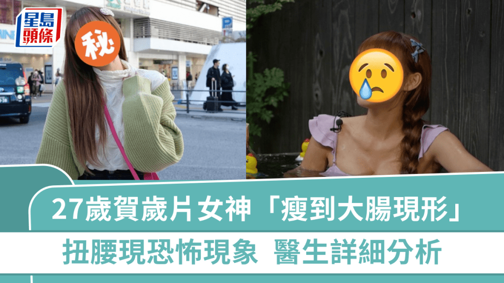 27歲賀歲片女神竟「瘦到大腸現形」？扭腰現恐怖現象  醫生詳細分析：和大便有關